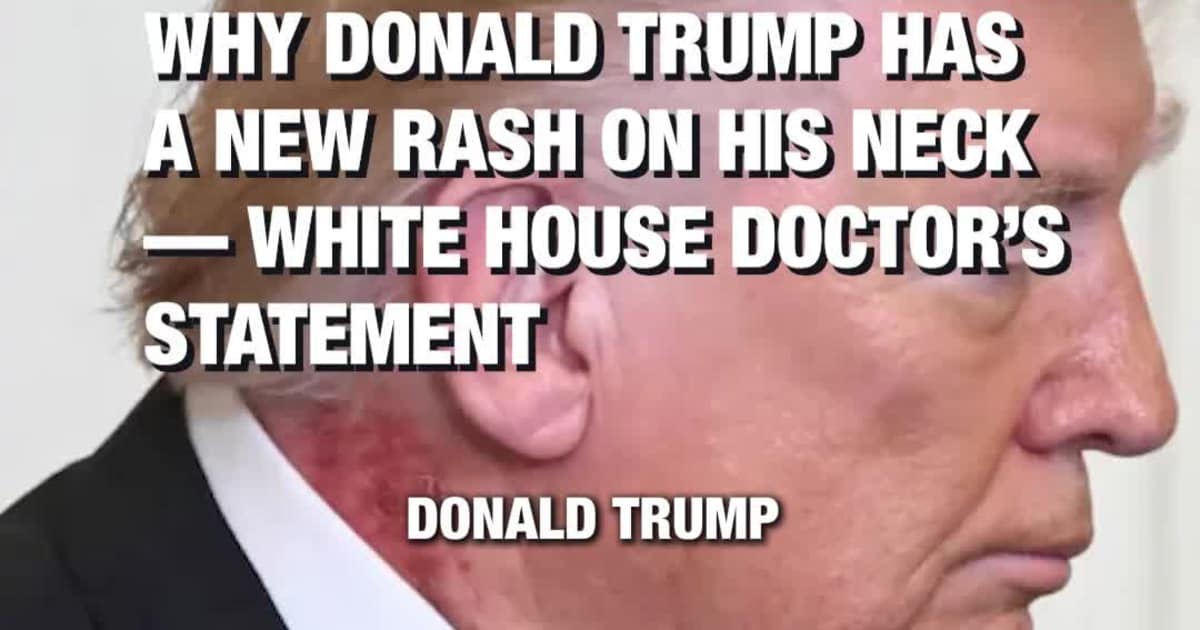 Why Donald Trump Has a New Rash on His Neck — White House Doctor’s Statement