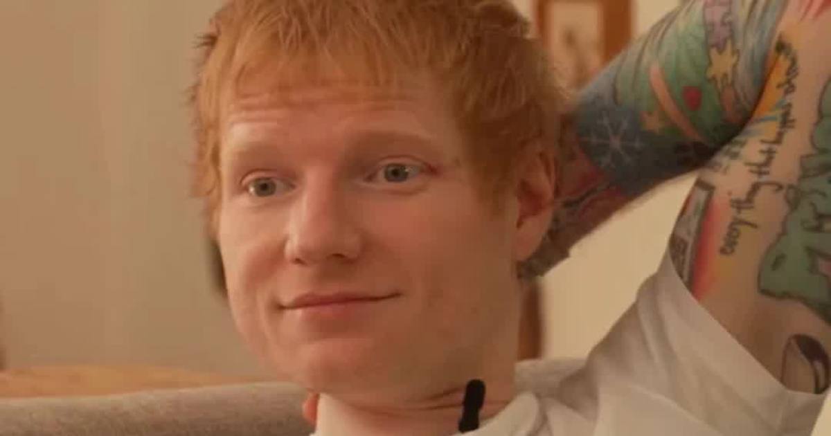 Ed Sheeran's Stupidest Purchase Actually Might Be His Coolest One Yet 'Edward Scissorhands' Hands
