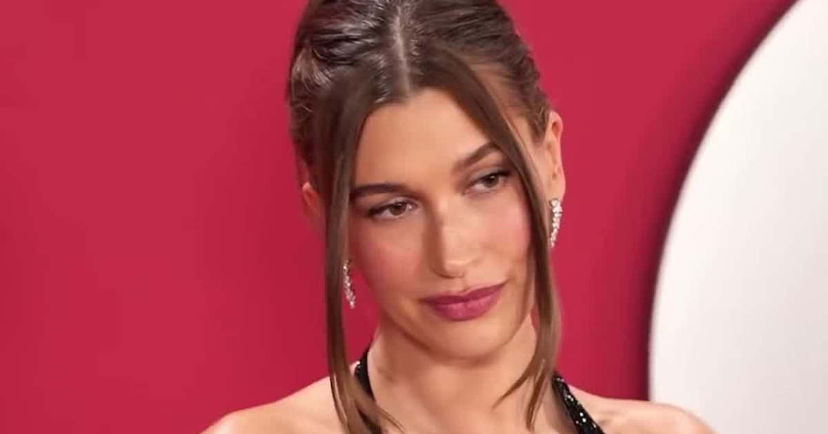 Hailey Bieber Reveals Black Eye After Baby Jack Blues Accident