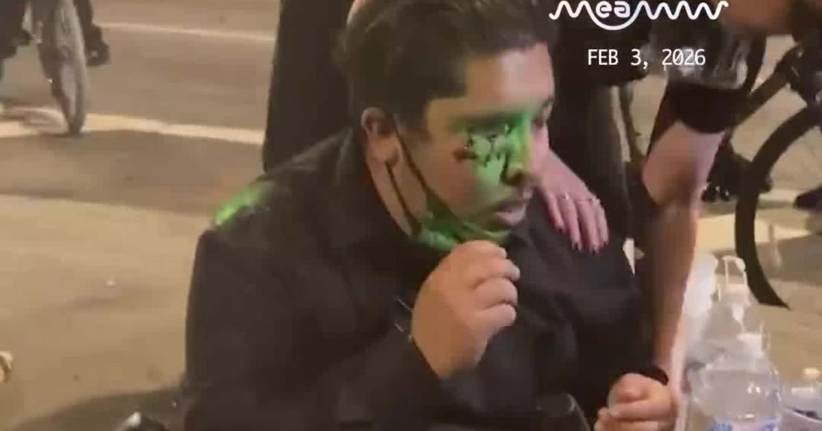 Man Sh*t in Eye With 'Less Lethal' Round as LA Protest Turns Violent