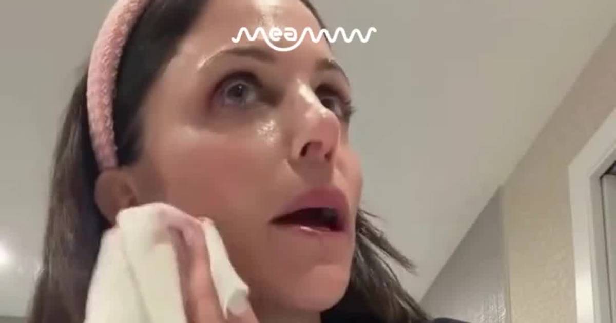 Bethenny Frankel Bleeds During Skincare Experiment